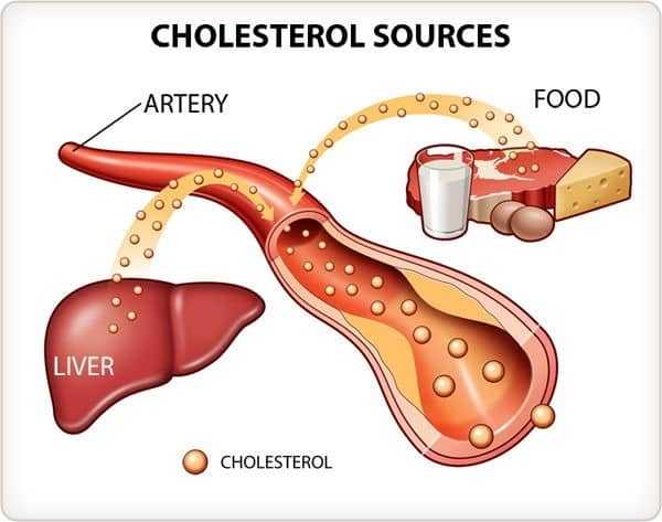 الكوليسترول Cholesterol ما اسباب ارتفاعه وكيفية علاجه