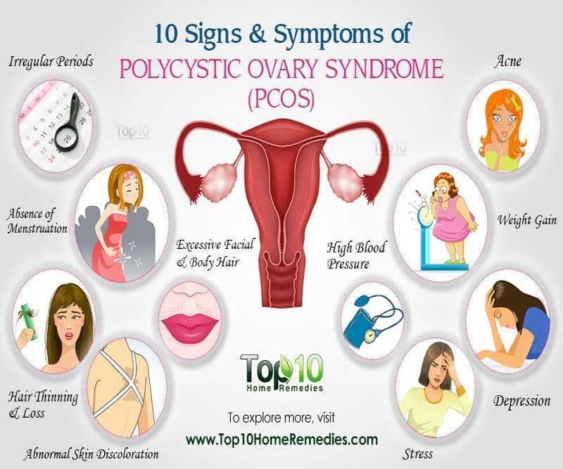 متلازمة تكيس المبايض Polycystic Ovary Syndrome