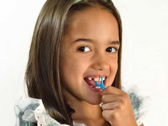 دراسة تحذر إعوجاج أسنان الطفل علامة على سوء التغذية