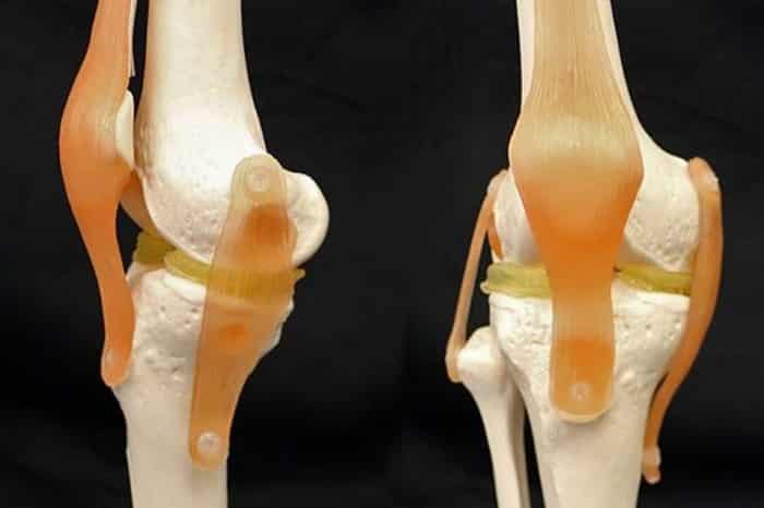 طباعة ناجحة لغضروف اصطناعي لمفصل الركبة