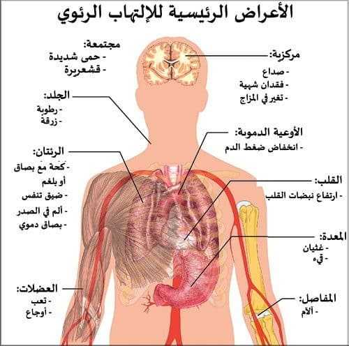 الالتهاب الرئوي Pneumonia