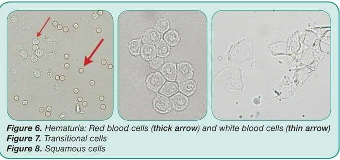 الخلايا البشرية والحرشفية
