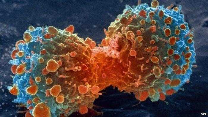 لقاح من الخلايا الجذعية المعدلة وراثيا قد يكون الدواء القادم للسرطان