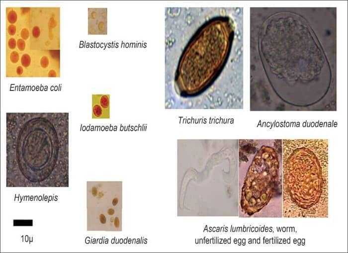 تحليل البراز Stool Analysis الدليل الطبي Altebby