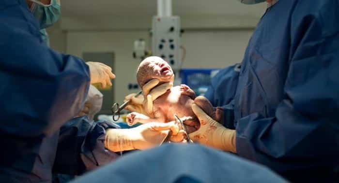 الرضاعة الطبيعية تحميكي من آلام ما بعد الولادة القيصرية