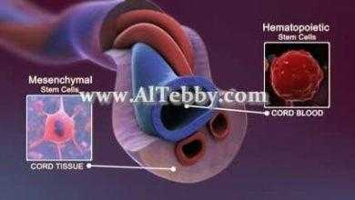 خلايا الحبل السري تتفوق على خلايا نخاع العظام في علاج القلب التالف