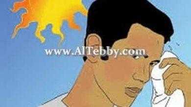 الاجهاد الحراري وضربة الشمس