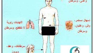 أكتشاف 3 اصابات جديدة بمرض الايدز خلال اسبوعين