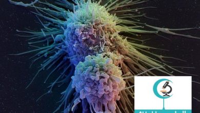 ثورة في العلاج المناعي تقضي على السرطان وتمنع عودته