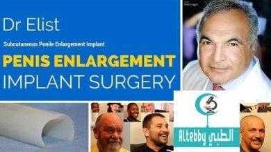 ابتكار شريحة سليكون تطيل العضو الذكري لأكثر من 5 سم