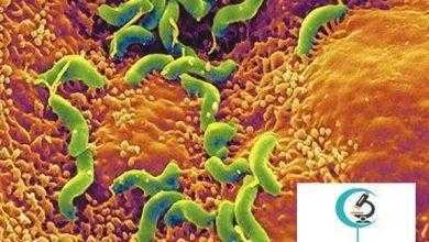 دراسة: عدوى مهبلية شائعة تمنع الانجاب