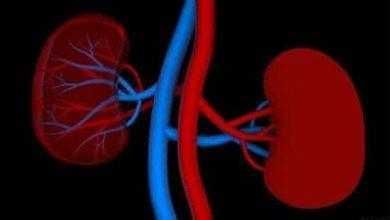 أمراض الكلى ترتبط بزيادة موجات الحرارة بسبب الجفاف