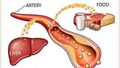 الكوليسترول Cholesterol ما اسباب ارتفاعه وكيفية علاجه