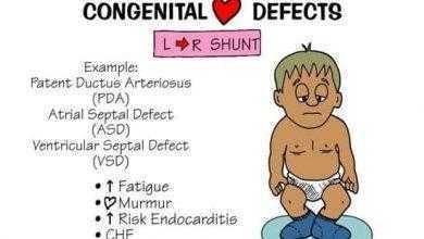أمراض القلب الخلقية Congenital Heart Diseases