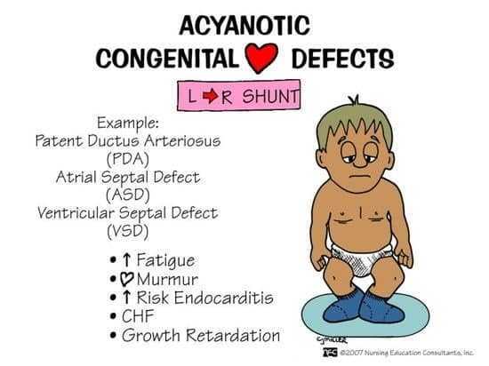أمراض القلب الخلقية Congenital Heart Diseases أمراض القلب الخلقية Congenital Heart Diseases