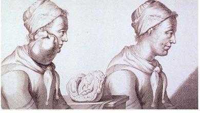 تاريخ السرطان History Of Cancer