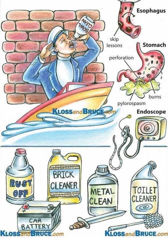 ابتلاع المواد الكاوية Corrosive ingestion Caustic-Ingestion-Acid-Color