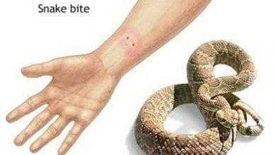 عضة الثعبان Snake Bite