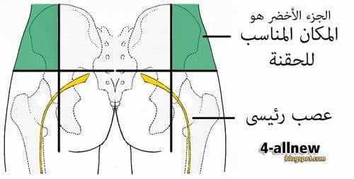 05- طريقة الحقن العضلي 05- طريقة الحقن العضلي