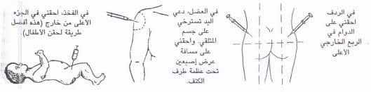 كيفية الحقن العضلي 1 كيفية الحقن العضلي 1