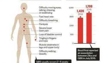 دراسة تجد صلة قوية بين زيكا ومتلازمة غيلان-باريه