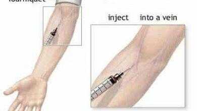 كيفية الحقن الوريدي Intravenous Injection