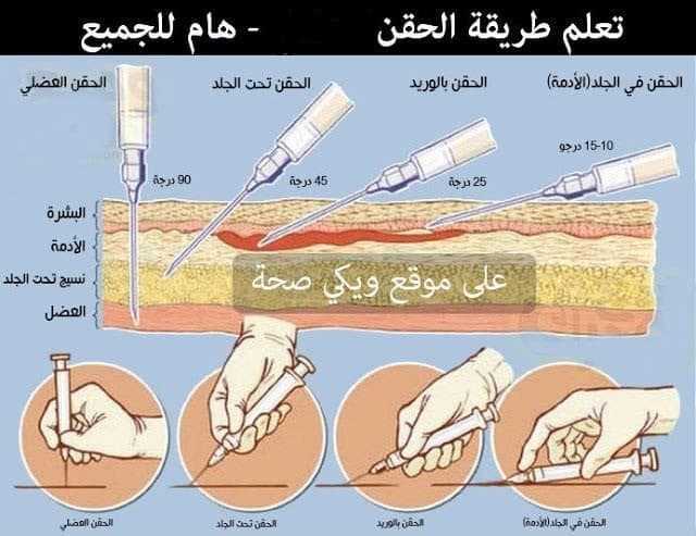 طرق الحقن طرق الحقن
