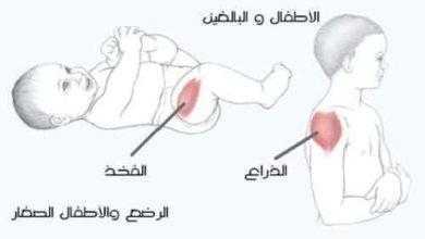 كيفية الحقن العضلي Intramuscular Injection