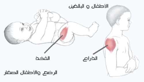 كيفية الحقن العضلي