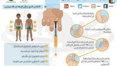 دراسة ضخمه وضحت كيفية الطريقة الصحيحة للحقن بالانسولين