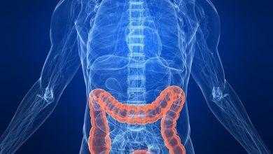 تناول المضادات الحيوية 15يوما أو أكثر ترفع الإصابة بسرطان الأمعاء 73%