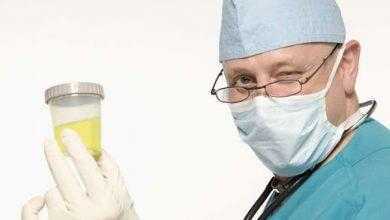 علماء يطورون تحليل بول لتشخيص انقطاع التنفس أثناء النوم