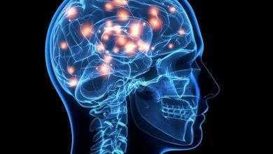 هل الدِّماغ مُنظَّم حسب وظائفه أم حسب أجزاء الجسم؟