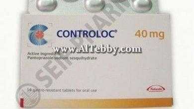 كونترولوك Controloc