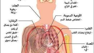 الالتهاب الرئوي Pneumonia