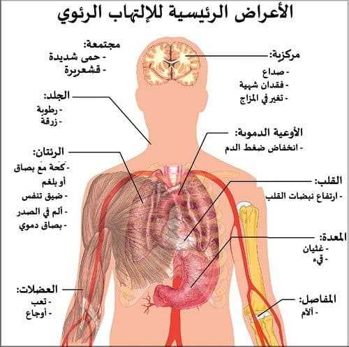 الالتهاب الرئوي Pneumonia الالتهاب الرئوي Pneumonia