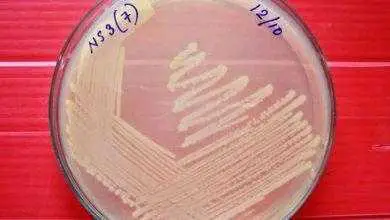 دراسة: بكتيريا مفترسة قد تصبح مضادا حيويا