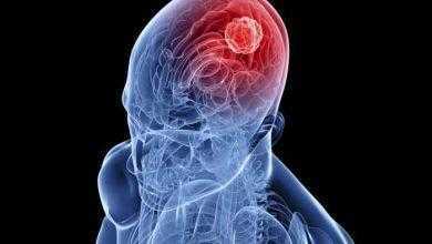 دراسة حديثة تُظهر أمان أحد اللقاحات المستخدمة في علاج الأورام الدماغية!