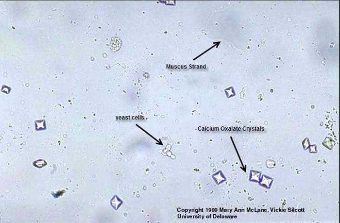 الفحص الميكروسكوبي الفحص الميكروسكوبي