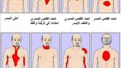 الأماكن المختلفة لألم الذبحة الصدرية Angina Pectoris