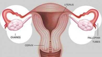 العنف الأسري والمجتمعي ضد المرأة يرتبط بزيادة خطر إزالة المبيضين