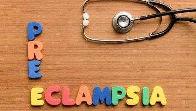 لأول مرة .. دراسة تكشف أن الجنين سبب حدوث تسمم الحمل