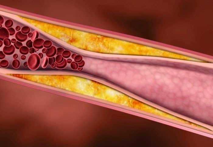 تحليل الدهون - Lipid profile تحليل الدهون - Lipid profile