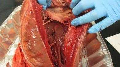 العلماء يكتشفون مادة تساعد خلايا القلب على تجديد نفسها