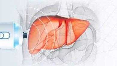 دراسة: تناول القهوة والشاي بانتظام يحميك من تصلب الكبد