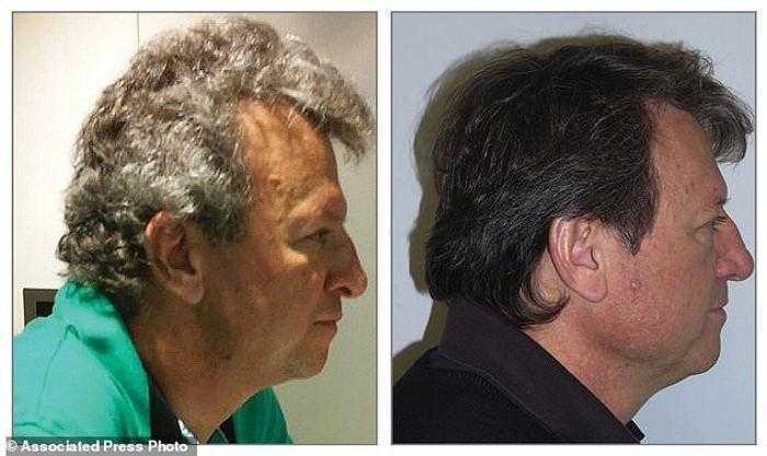 دراسة أدوية جديدة للسرطان تحول الشعر الأبيض للبني ولا تسبب تساقط الشعر دراسة أدوية جديدة للسرطان تحول الشعر الأبيض للبني ولا تسبب تساقط الشعر