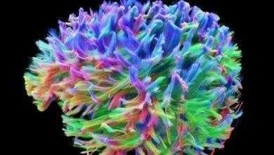 العلماء يتمكنون من تطوير تقنية دقيقة للغاية لتصوير الدماغ