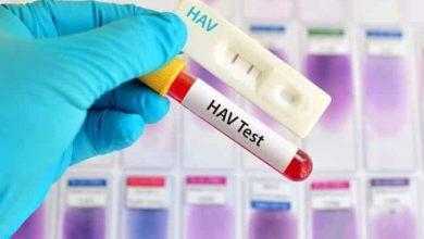 تحليل التهاب الكبد (أ) - Hepatitis A Virus Test