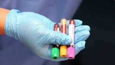 دلالات الفيروسات الكبدية – Hepatitis Markers