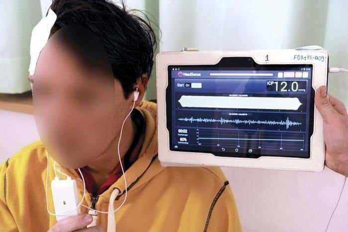 علماء ألمان يتمكنون من تطوير تقنية جديدة لقياس الضغط داخل الجمجمة علماء ألمان يتمكنون من تطوير تقنية جديدة لقياس الضغط داخل الجمجمة